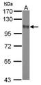 DLG Associated Protein 2 antibody, NBP2-42835, Novus Biologicals, Western Blot image 