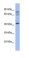 SLAIN Motif Family Member 2 antibody, orb330999, Biorbyt, Western Blot image 