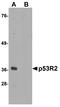Ribonucleoside-diphosphate reductase subunit M2 B antibody, A03055-1, Boster Biological Technology, Western Blot image 