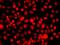 Nuclear Receptor Subfamily 2 Group E Member 1 antibody, GTX57753, GeneTex, Immunofluorescence image 