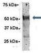 Ras GTPase-activating protein-binding protein 1 antibody, GTX47440, GeneTex, Immunoprecipitation image 