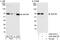 Zinc Finger Protein 768 antibody, A302-388A, Bethyl Labs, Immunoprecipitation image 
