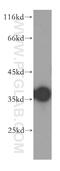 Coproporphyrinogen Oxidase antibody, 12211-1-AP, Proteintech Group, Western Blot image 
