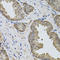 Immunoglobulin Superfamily Member 3 antibody, A11572, Boster Biological Technology, Immunohistochemistry paraffin image 