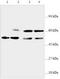 Sterol O-acyltransferase 2 antibody, TA310033, Origene, Western Blot image 
