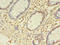 ETHE1 Persulfide Dioxygenase antibody, A58974-100, Epigentek, Immunohistochemistry paraffin image 