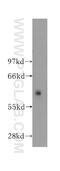 Sodium/potassium-transporting ATPase subunit beta-3 antibody, 11142-1-AP, Proteintech Group, Western Blot image 