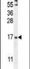 Zinc Finger Protein 720 antibody, PA5-24499, Invitrogen Antibodies, Western Blot image 