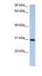 PDZ Domain Containing 9 antibody, NBP1-56800, Novus Biologicals, Western Blot image 