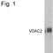 Voltage Dependent Anion Channel 2 antibody, PA1-958, Invitrogen Antibodies, Western Blot image 