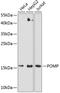 Proteasome maturation protein antibody, A04837, Boster Biological Technology, Western Blot image 