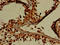 Glycyl-TRNA Synthetase antibody, orb48232, Biorbyt, Immunohistochemistry paraffin image 