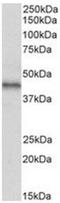 Atypical Chemokine Receptor 3 antibody, NBP2-44325, Novus Biologicals, Western Blot image 