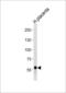 DAB Adaptor Protein 2 antibody, LS-B12091, Lifespan Biosciences, Western Blot image 