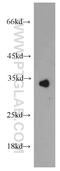 Collectin-11 antibody, 15269-1-AP, Proteintech Group, Western Blot image 