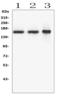 E3 ubiquitin-protein ligase RNF123 antibody, A09642-1, Boster Biological Technology, Western Blot image 