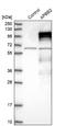 Amyloid beta A4 precursor protein-binding family B member 2 antibody, NBP1-84700, Novus Biologicals, Western Blot image 