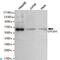 General Transcription Factor IIH Subunit 1 antibody, LS-C812983, Lifespan Biosciences, Western Blot image 