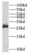 Myeloid Leukemia Factor 2 antibody, FNab05212, FineTest, Western Blot image 