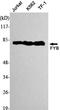 ADAP antibody, STJ98493, St John