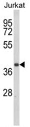 C-C chemokine receptor type 3 antibody, AP17930PU-N, Origene, Western Blot image 