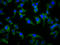 Signal Peptide Peptidase Like 2B antibody, LS-C681453, Lifespan Biosciences, Immunofluorescence image 