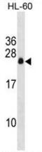 Chromosome 3 Open Reading Frame 35 antibody, AP50218PU-N, Origene, Western Blot image 