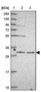 RING finger protein 170 antibody, NBP2-48986, Novus Biologicals, Western Blot image 