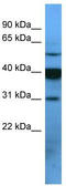 Olfactory Receptor Family 2 Subfamily T Member 1 antibody, TA342719, Origene, Western Blot image 