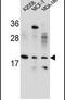 Variable Charge X-Linked antibody, PA5-24314, Invitrogen Antibodies, Western Blot image 