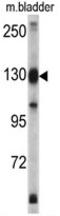 Exportin 1 antibody, AP17839PU-N, Origene, Western Blot image 
