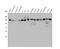 Ubiquitin Specific Peptidase 25 antibody, A06182-1, Boster Biological Technology, Western Blot image 