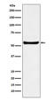 F2R Like Trypsin Receptor 1 antibody, M01081, Boster Biological Technology, Western Blot image 