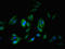Synemin antibody, LS-C671425, Lifespan Biosciences, Immunofluorescence image 
