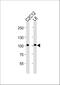 Muscle Associated Receptor Tyrosine Kinase antibody, M00815, Boster Biological Technology, Western Blot image 