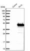 Glutamate-Ammonia Ligase antibody, NBP1-89768, Novus Biologicals, Western Blot image 