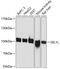 SEL1L Adaptor Subunit Of ERAD E3 Ubiquitin Ligase antibody, GTX64717, GeneTex, Western Blot image 