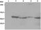 LYN Proto-Oncogene, Src Family Tyrosine Kinase antibody, M01424, Boster Biological Technology, Western Blot image 