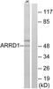 Arrestin domain-containing protein 1 antibody, PA5-38848, Invitrogen Antibodies, Western Blot image 