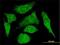 S100 Calcium Binding Protein A10 antibody, H00006281-M01, Novus Biologicals, Immunofluorescence image 