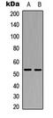 X-Linked Inhibitor Of Apoptosis antibody, LS-C358397, Lifespan Biosciences, Western Blot image 