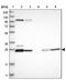 Haloacid Dehalogenase Like Hydrolase Domain Containing 3 antibody, NBP1-86706, Novus Biologicals, Western Blot image 
