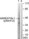 ARRB1 antibody, TA312684, Origene, Western Blot image 