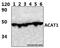 Acetyl-CoA Acetyltransferase 1 antibody, A02008, Boster Biological Technology, Western Blot image 