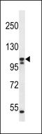 Solute Carrier Family 12 Member 6 antibody, LS-C161129, Lifespan Biosciences, Western Blot image 