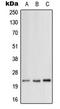 Mitochondrial Ribosomal Protein L12 antibody, LS-C352794, Lifespan Biosciences, Western Blot image 
