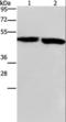 Clusterin-associated protein 1 antibody, LS-C404828, Lifespan Biosciences, Western Blot image 