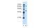 Leucine Rich Repeat Containing 26 antibody, PA5-42617, Invitrogen Antibodies, Western Blot image 