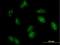 Regulator of nonsense transcripts 3A antibody, H00065110-B01P, Novus Biologicals, Immunocytochemistry image 