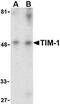 KIM-1 antibody, PA1-86790, Invitrogen Antibodies, Western Blot image 